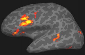 chp_black_brain_1